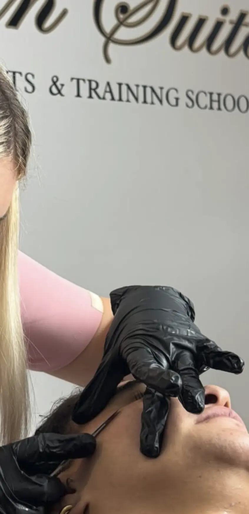 dermaplaning age limit